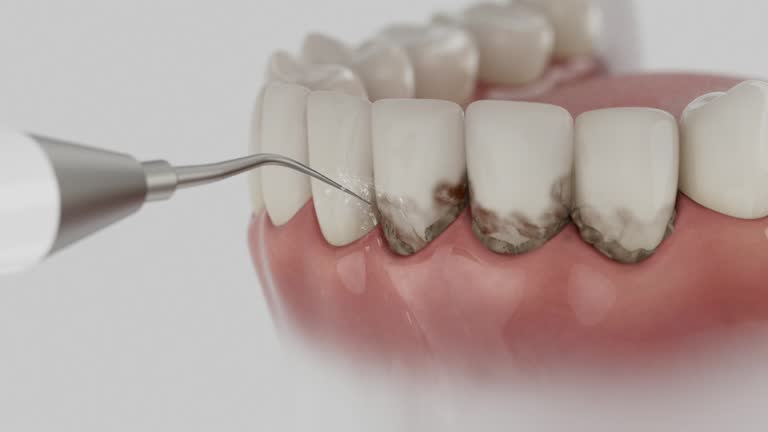 Reliable Dental contractor in Hebron, OH by Smile Center Dentistry